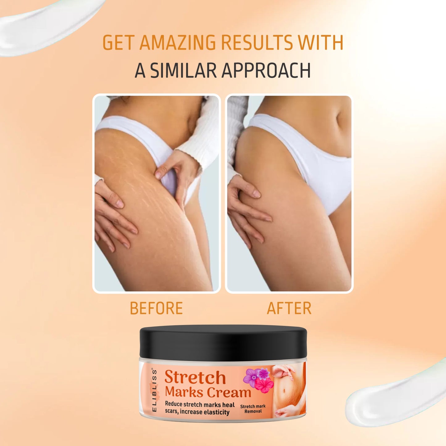 Stretch Marks Cream for Reducing Stretch Marks & Scars